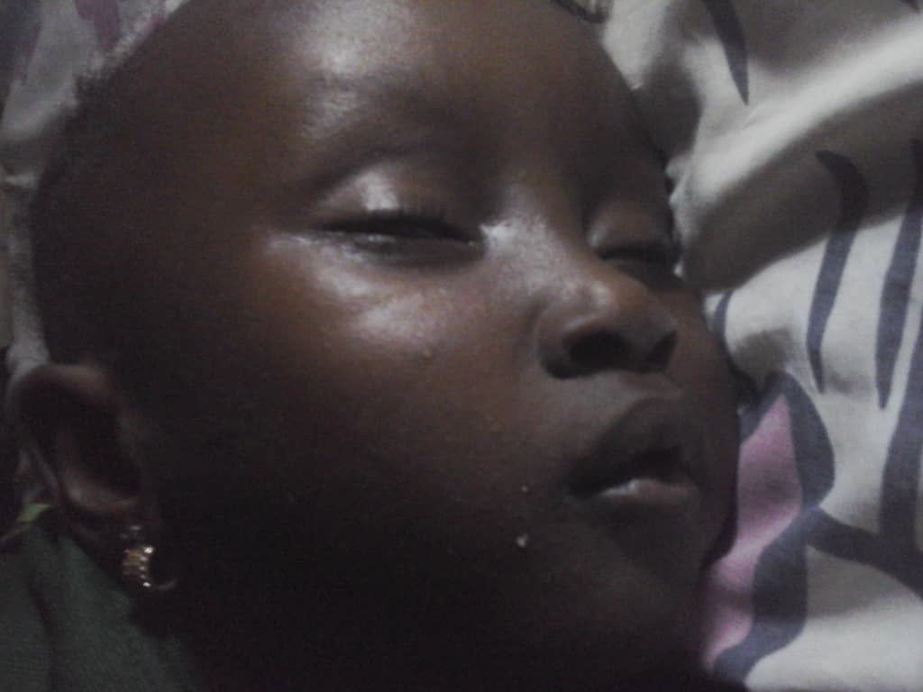 4-Year-OldGirl With Rare Medical Condition Overseas Treatment –